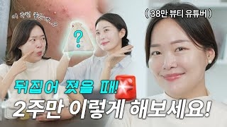 🆘응급 스킨케어 루틴! 피부 갑자기 뒤집어졌을 때 2주만 이렇게 하세요! | 디어 마이 프렌즈 아기자기 장벽루틴편