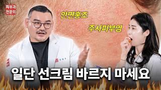 🚨안면홍조, 주사피부염🚨 현실적인 민감피부 솔루션 공개합니다!